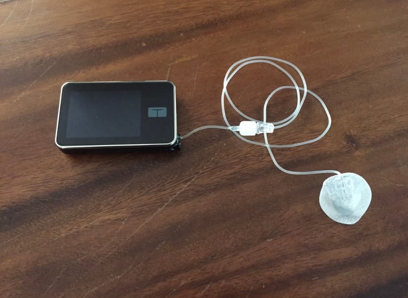 insulin pump and tubing on a table